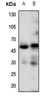 ADRB2 antibody