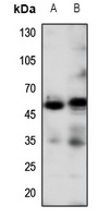 Anti-Beta-2 Adrenergic Receptor Antibody