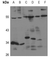 Anti-EDG5 Antibody