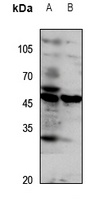 SLC52A2 antibody