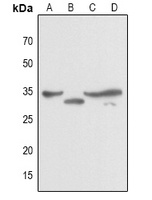 JUNB antibody