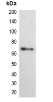 His-tag antibody