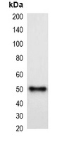 MBP-tag antibody