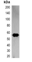 RFP antibody