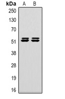 Carbonic Anhydrase 9 antibody