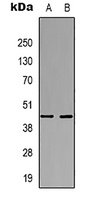 CD23 antibody