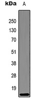 Anti-Histone H3 (DiMethyl-K27) Antibody