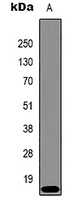 Histone H3 (TriMethyl K9) antibody