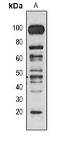 Methyl Lysine antibody