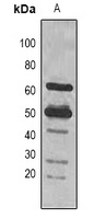 Anti-Rubisco Large Chain Antibody