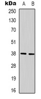 Anti-XRCC4 Antibody