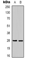 Anti-14-3-3 epsilon Antibody