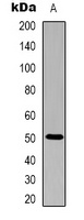 Anti-Alliinase Antibody