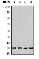 Anti-AMPK beta 2 Antibody