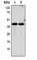 Anti-GRPR Antibody