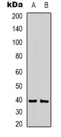 Anti-CABP1 Antibody