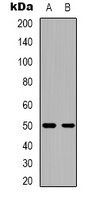 Anti-CACNB3 Antibody