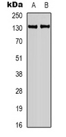 Anti-Calcium Sensing Receptor Antibody