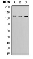 EPHA1 antibody