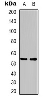 Anti-GLP-1 Receptor Antibody