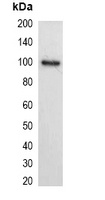 Anti-His-tag Antibody-HRP labled