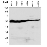 Anti-Beta-tubulin Antibody-HRP labled