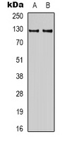 Anti-HIF1 alpha Antibody