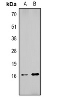 Histone H1 (DiMethyl K25) antibody