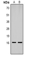 Histone H1 (MonoMethyl K25) antibody