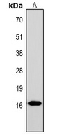 Histone H1 (Phospho-T17) antibody