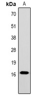 Histone H1 (TriMethyl K25) antibody