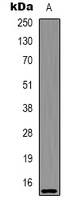 Histone H2A.X (AcK5) antibody