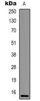 Histone H2A.X (Phospho-S139) antibody