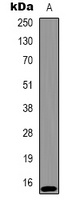Histone H2A.X (Phospho-T120) antibody