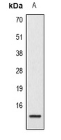 Histone H2B (AcK15) antibody