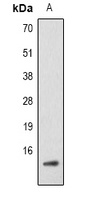 Histone H2B (AcK5) antibody