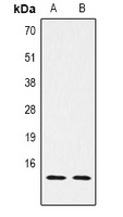 Histone H2B (DiMethyl K5) antibody