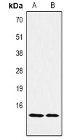 Histone H2B (MonoMethyl K5) antibody