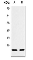 Histone H2B (TriMethyl K43) antibody