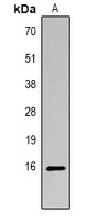 Histone H3 (AcK14) antibody
