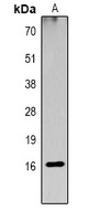 Histone H3 (AcK23) antibody