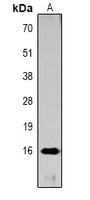 Histone H3 (AcK27) antibody