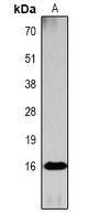 Histone H3 (AcK36) antibody