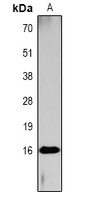 Histone H3 (AcK4) antibody