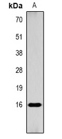 Histone H3 (AcK9) antibody