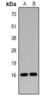 Histone H3 (DiMethyl K14) antibody