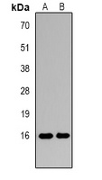 Histone H3 (DiMethyl K27) antibody