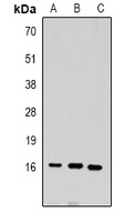 Histone H3 (DiMethyl K9) antibody