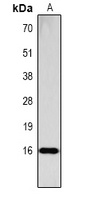 Histone H3 (Phospho-S28) antibody