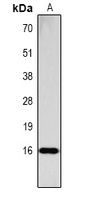 Anti-Histone H3 (Phospho-S28) Antibody